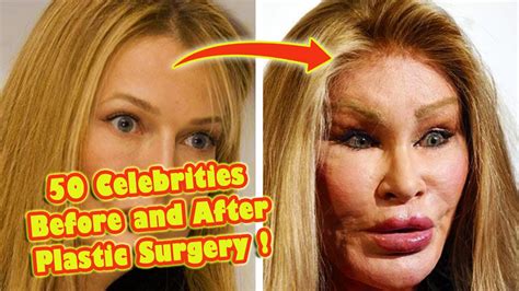how many people died from plastic surgery